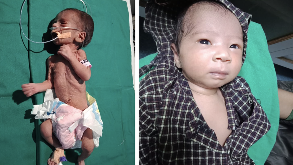 Beba je u bolnicu dovedena u kritinom stanju/Dr Ravi Khanna