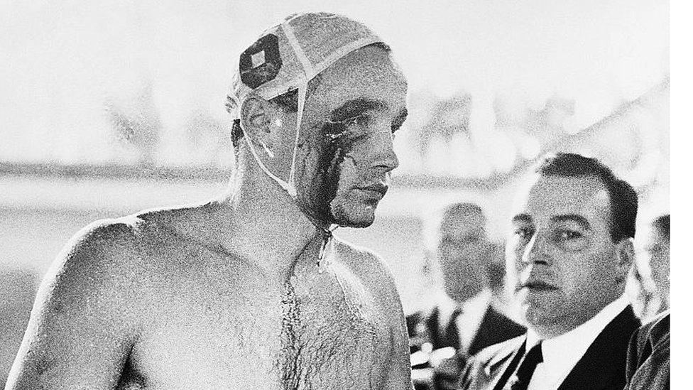Maarski vaterpolista Ervin Zador povreen je tokom tue sa ruskim igraima na Olimpijskim igrama u Melburnu 1956./Getty Images