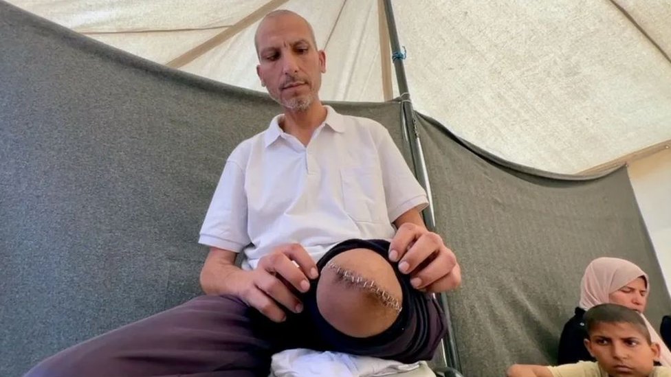 Sufijanu je amputirana noga i on je kasnije puten nazad u Gazu/BBC