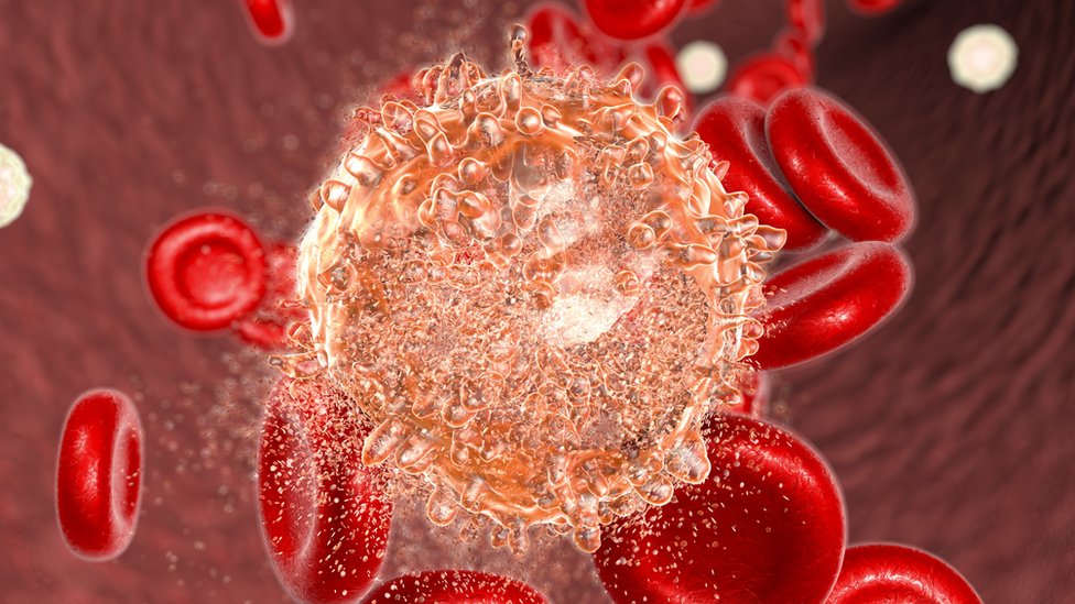 elije crvenih krvnih zrnaca/SCIENCE PHOTO LIBRARY
