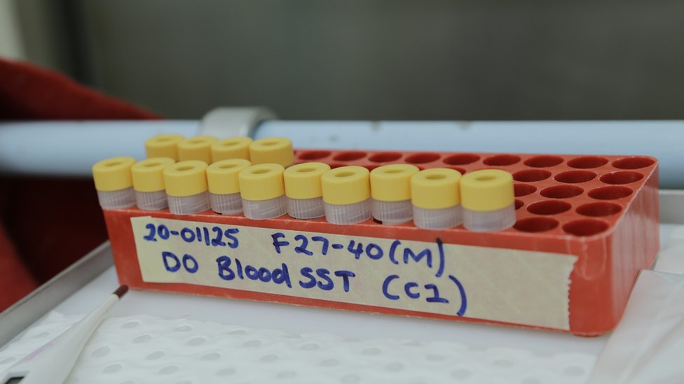 U ovoj fazi se testiraju dve potencijalne vakcine/CSIRO