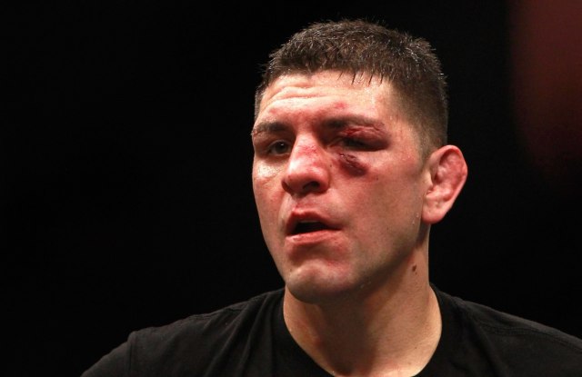 Nik Dijaz, UFC (Foto: Profimedia) 