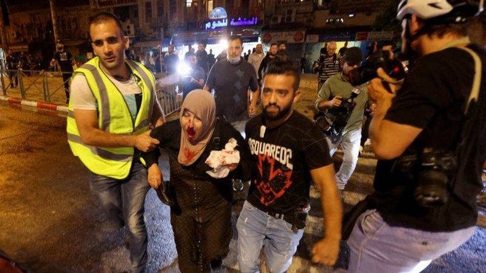 Veliki broj povreenih u sukobima izraelskih snaga bezbednosti i Palestinaca/Reuters