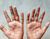 Foto: Shutterstock/shinoportogis