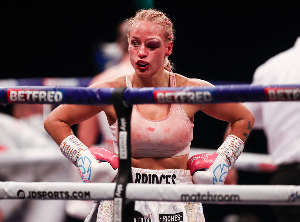 Ebani Bridis iz Australije zadobila je nezgodnu povredu oka tokom borbe za titulu u kateforiji bantam za ene, boksujui u Londonu u aprilu 2021. godine protiv domae takmiarke enon Kortini/RICHARD PELHAM