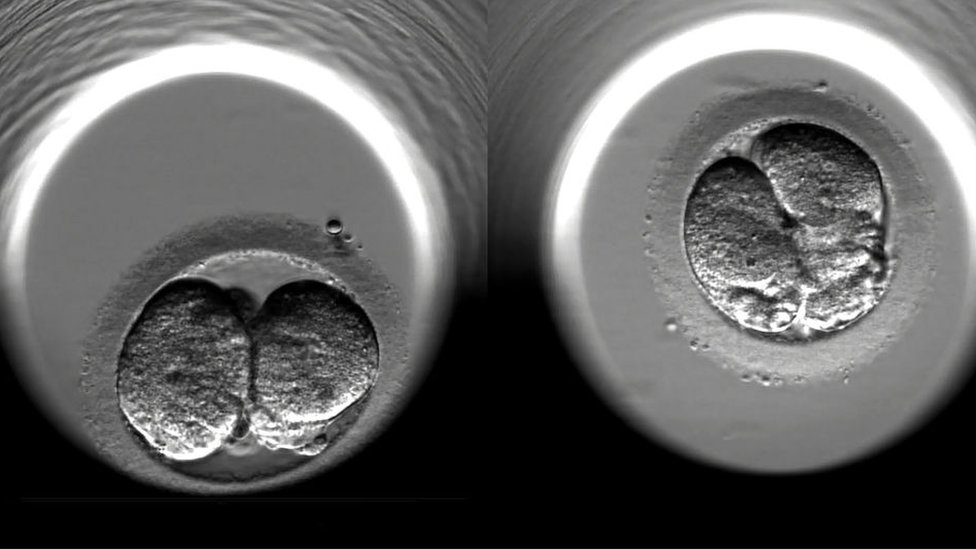 Ljudski embrioni tokom vantelesne oplodnje/Getty Images