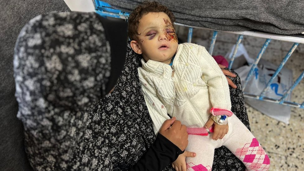 Dvogodišnja Muna Alvan je izgubila roditelje, brata i deku u vazdušnom napadu u severnom delu Gaze/Mohamed Al-Kolaut