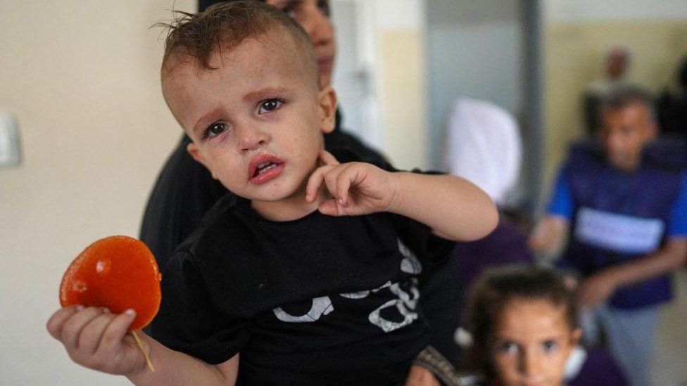 Palestinska deca koja pate od neuhranjenosti ili hroninih bolesti ekaju sa lanovima porodice u bolnici Naser u Kan Junisu u junom pojasu Gaze 24. juna 2024./Getty Images